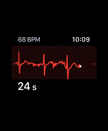 App ECG, battements par minute en haut à droite, tracé, compte à rebours