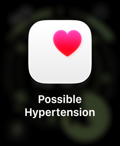 Apple Watch Ultra 3 у титановому корпусі натурального кольору, сповіщення про ймовірність гіпертензії, рожеве серце в білому віконці, браслет Trail синього / яскраво-блакитного кольору